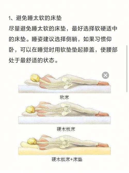 睡姿建议选择侧躺,如果习惯仰卧,可以在睡觉时用软垫垫起膝盖,使腰部