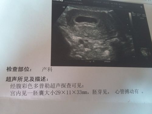 怀孕43天 胚囊大小29*11*33mm.是男孩还是女孩啊?