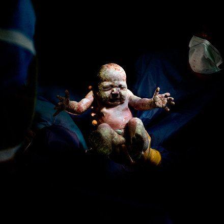 摄影师拍下刚出生那几秒婴儿的照片,有点血腥,却很震撼!