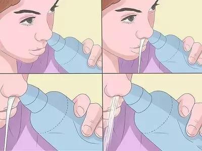 孕妇鼻炎怎么治有什么方法