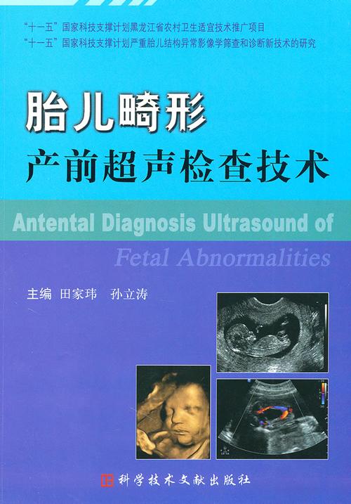 胎儿畸形产前超声检查技术
