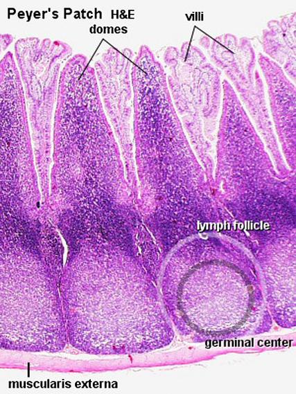 斑,派尔斑,pp结,肠道集合淋巴结,peyer patch等,是肠 a>黏膜免疫系统