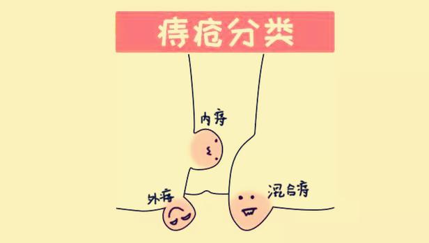 重庆大渡口肛肠医院提醒:痔疮的类型是按其发生部位区分,主要是