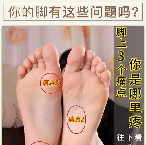 治脚后跟疼足跟骨刺足底筋膜炎跟腱炎产后足跟痛行走