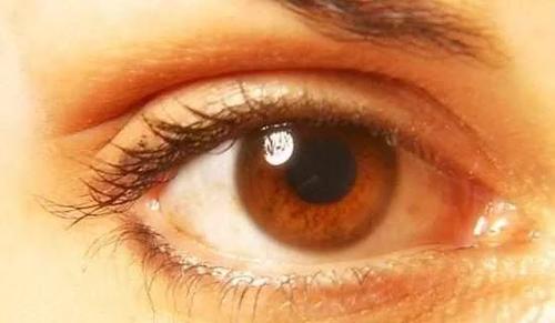 眼睛出现这个症状,代表身体患上高血压,糖尿病,千万要重视!
