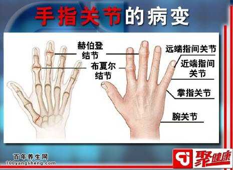手指关节的病变