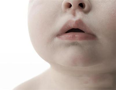 八个月宝宝流鼻涕咳簌并不发烧用什么方法可以治好