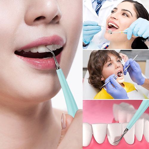 家用电动洁牙器牙结石去除神器去牙垢去牙渍口腔清理工具电动牙刷