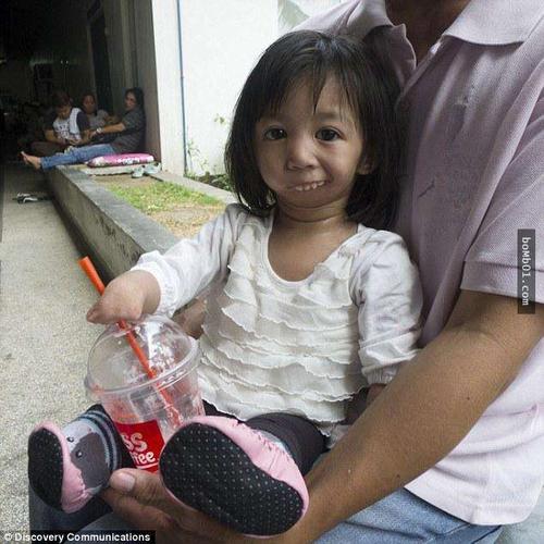 来自菲律宾马尼拉的3岁小女孩紫水晶(amethyst santos),自诞生以来就