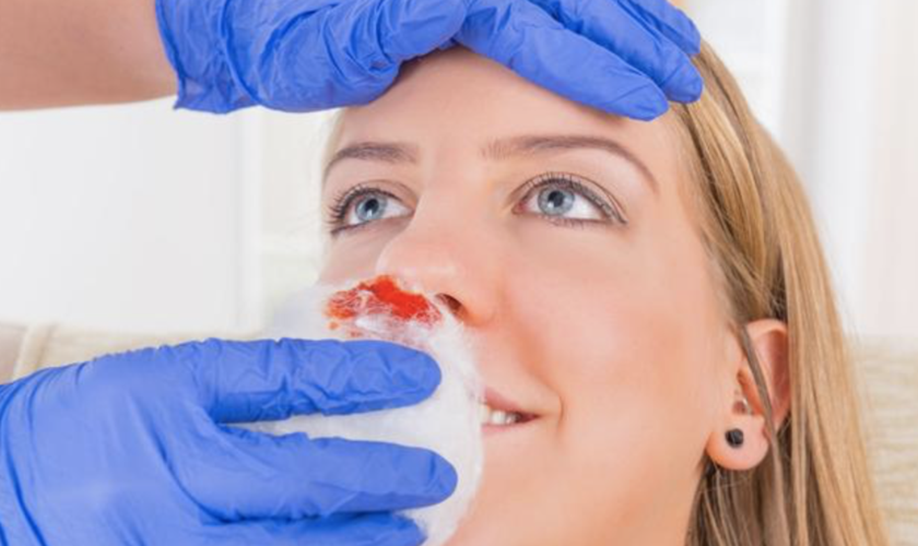 儿童过敏性鼻炎会引起流鼻血吗