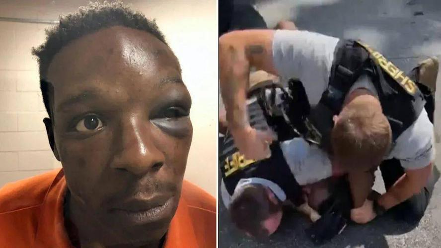 新闻今年2月,路易斯安那州一名13岁的黑人男孩被警察压在地上扼住脖子