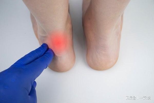 从而导致形成足跟骨增生,主要症状为脚后跟疼痛,尤其是在行走的时候