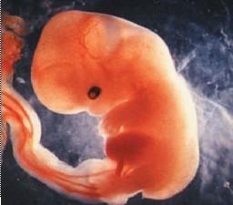 怀孕第9周胎儿图