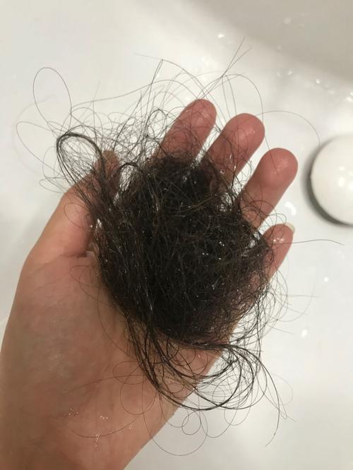 洗头的时候掉很多头发