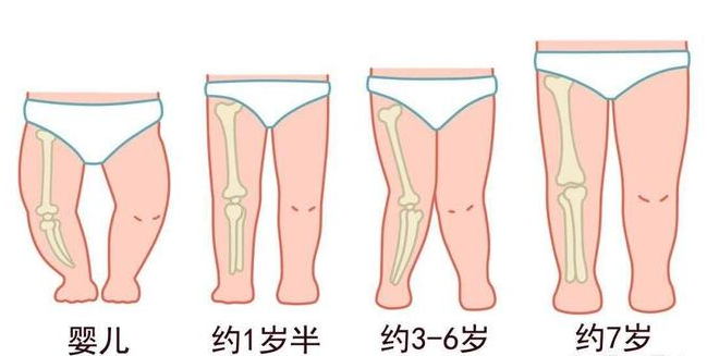 宝宝腿部发育过程图