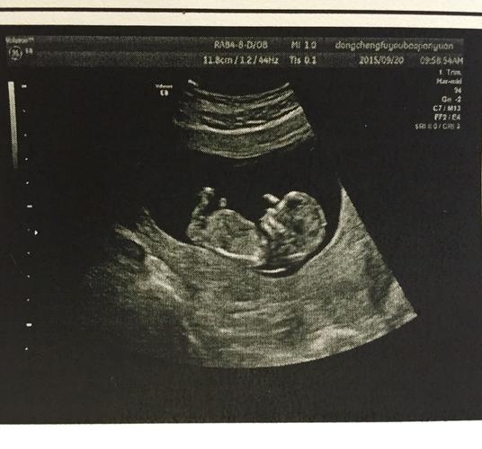 怀孕12周胎儿真实图片