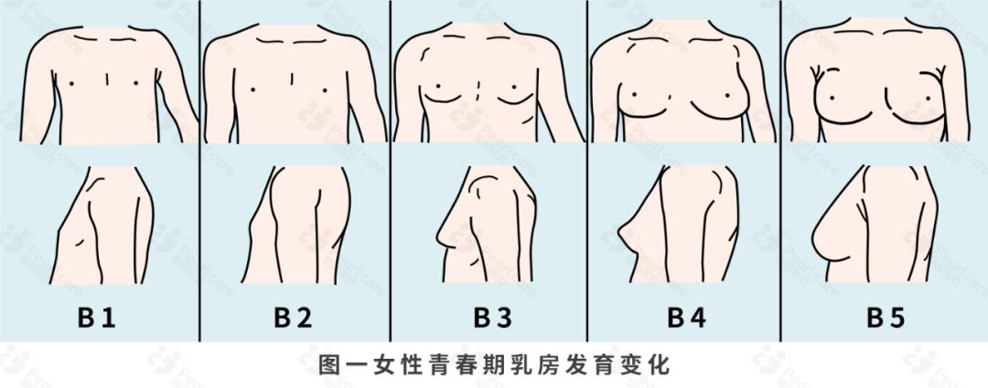乳房作为女性其中一个性征,从儿童期到成年期按照女孩乳房发育性成熟