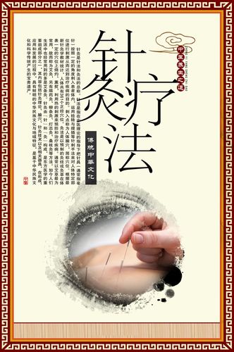 763海报印制展板写真素材165中医养生文化针灸疗法挂图画