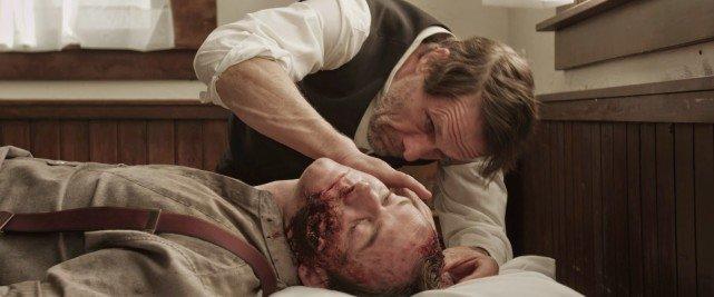 医生给他处理伤口时,简直就像《终结者》电影重现:医生将头骨碎片挑出