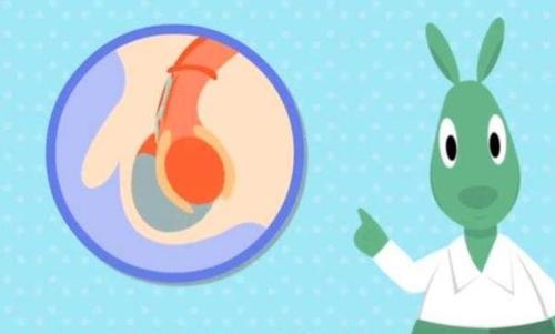 婴儿先天性重复肾是什么原因