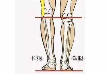 当双下肢不等长会使骨盆倾斜,身体左右不对称,机体为维持稳定性,脊柱