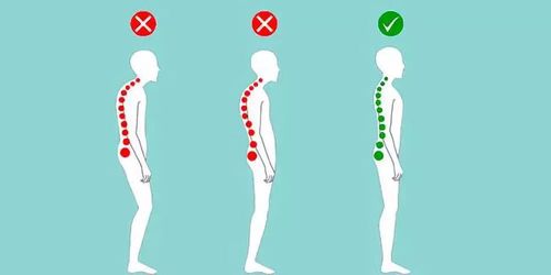 脊柱变形易导致肩背部,腰部顽固性疼痛,严重者甚至