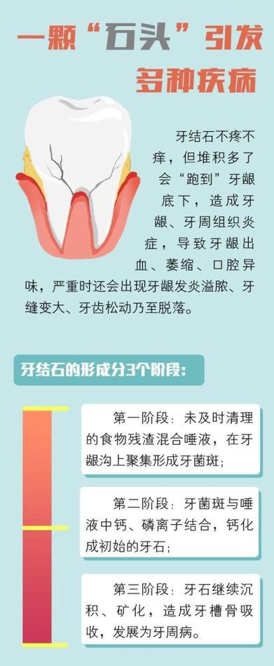 假如牙石在初期获得立即清除,就不可能发生牙槽骨萎缩,牙齿也不会出现