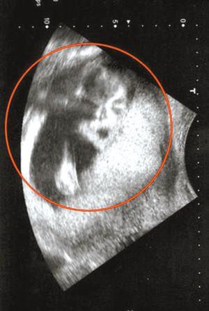 英国胎儿b超显示长有杰克逊脸图