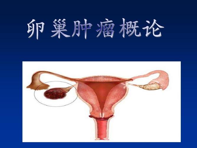 妊娠合并卵巢肿瘤 卵巢肿瘤超声 卵巢肿瘤论文 卵巢恶性肿瘤 卵巢良