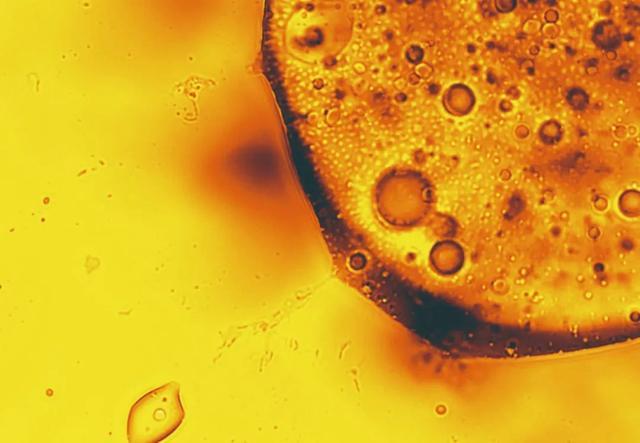 这张显微图像显示了嗜油菌将石油分解成更小的圆球.