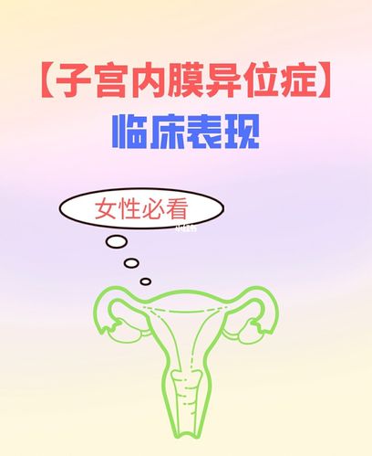 女性必看子宫内膜异位症临床表现