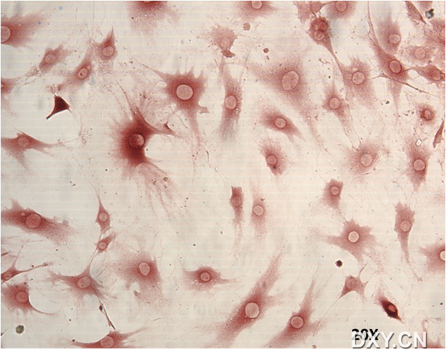 p16细胞免疫染色阳性