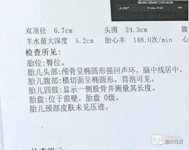 从刘先生提供的检查单可以看到,每次b超都没有提示胎儿有异常.