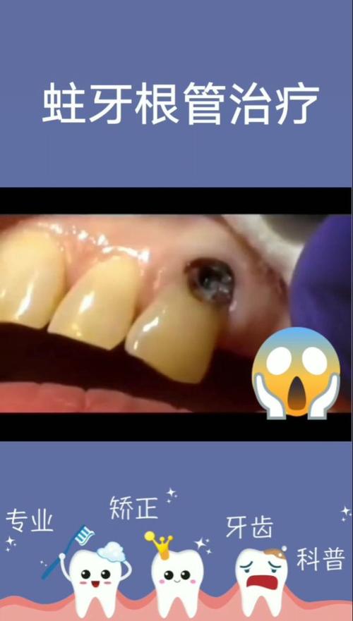 原来牙髓是这样子的,你的牙齿上有黑洞嘛?