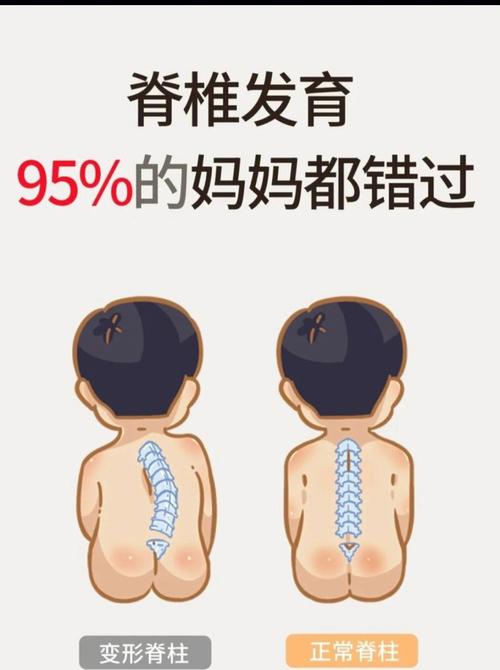没有重视对孩子的脊椎保护,导致了脊椎或轻或重的变形.