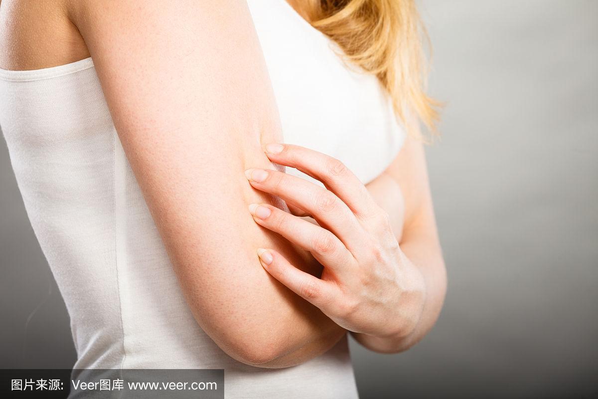一个女人用过敏皮疹挠她发痒的手臂