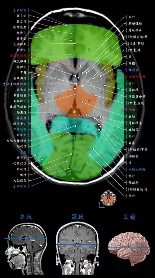 大脑解剖3d示意图