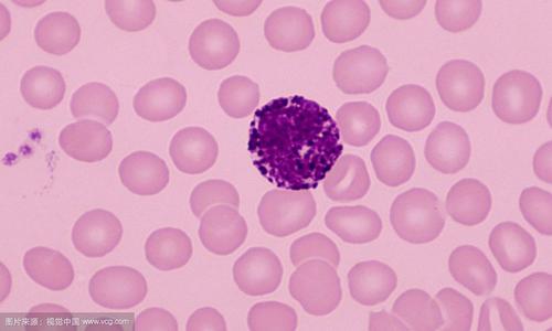 嗜碱性粒细胞,胞质内及胞核上含有紫黑色,大小不匀,数量较少的嗜碱性