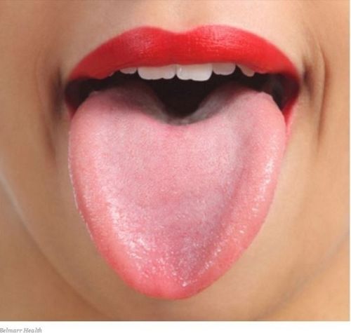 普通人的舌头图片
