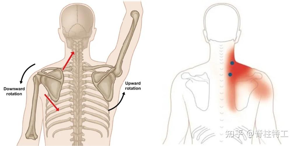 翼状肩是一种不良体态,主要跟肌肉骨骼和神经系统相关.