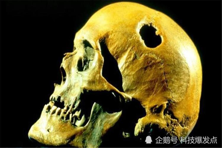 在南极发现圆柱形的头骨被认为是外星人dna检测揭晓身份