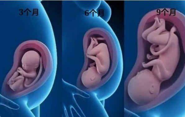 孕4个月胎儿位置低怎么办