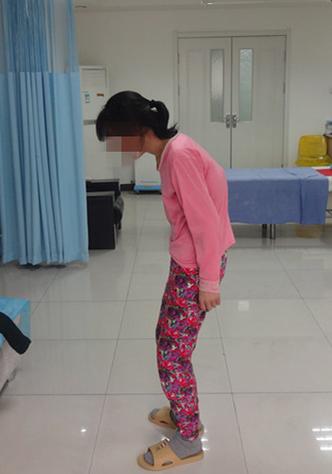 南京强脊诊疗中心 南京看强直性脊柱炎的专业医院