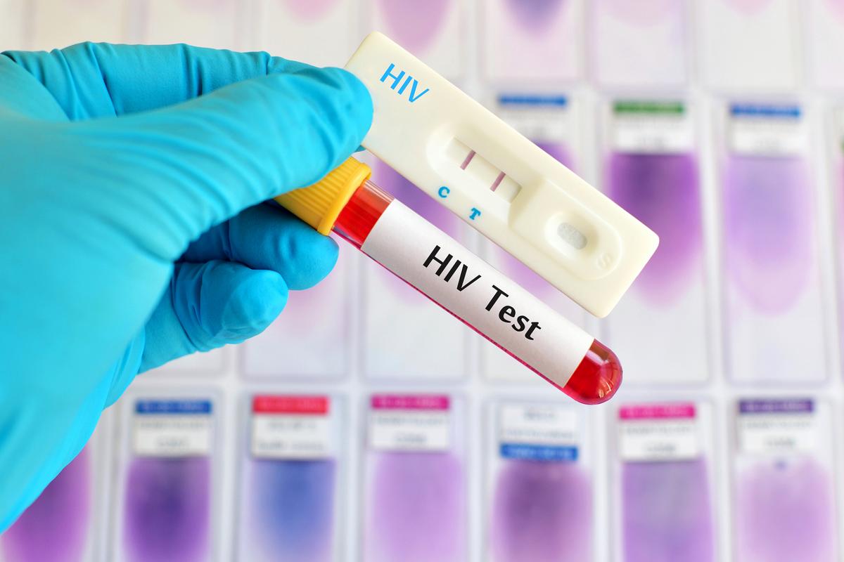 感染艾滋病后,一般4~6周左右可以检测出来.