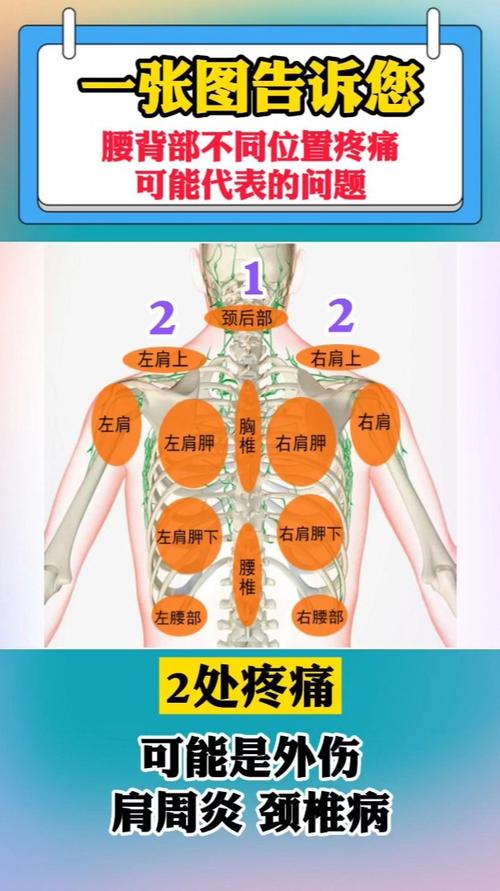 一张图告诉您腰背部不同位置疼痛可能代表的问题