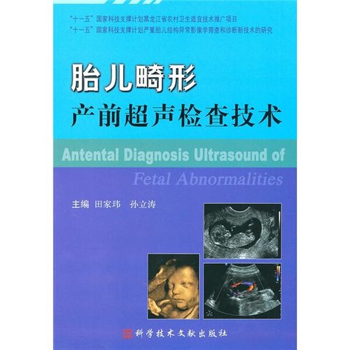 (满48免邮)胎儿畸形产前超声检查技术9787502367657上海科学技术文献