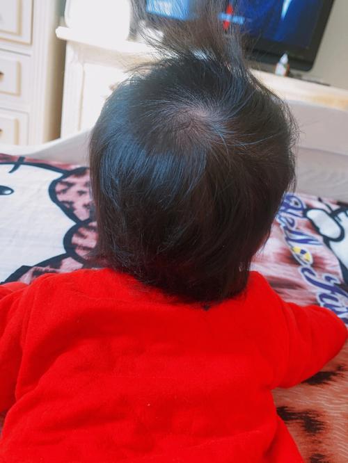 快4个月宝宝一头黑发