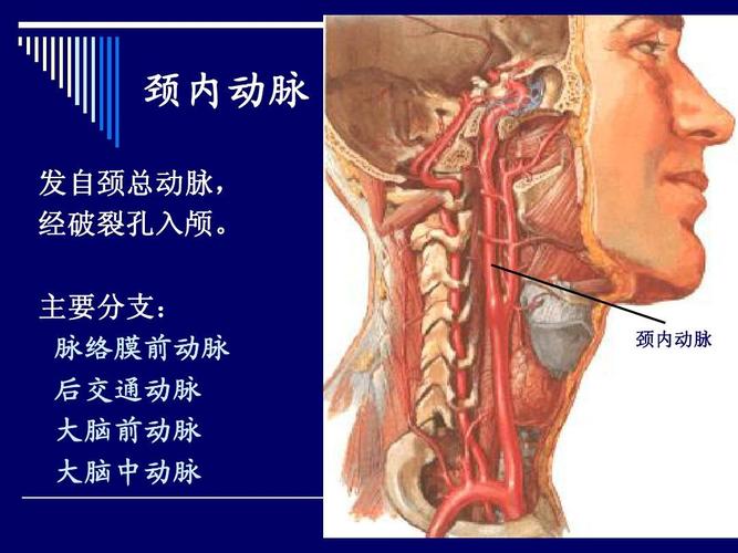 颈内动脉分段解剖图