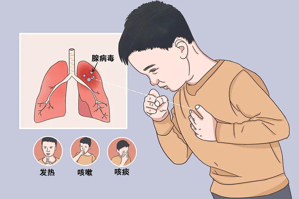 干咳不发烧会是肺炎吗