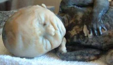 打胎后婴儿的真实照片 堕胎婴儿医院怎么处理